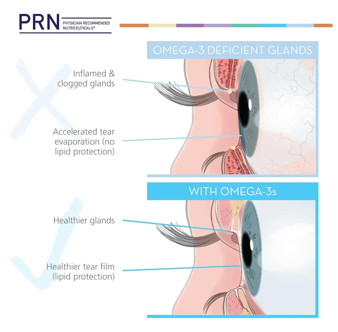 PRN De3 Dry Eye Omega Benefits®